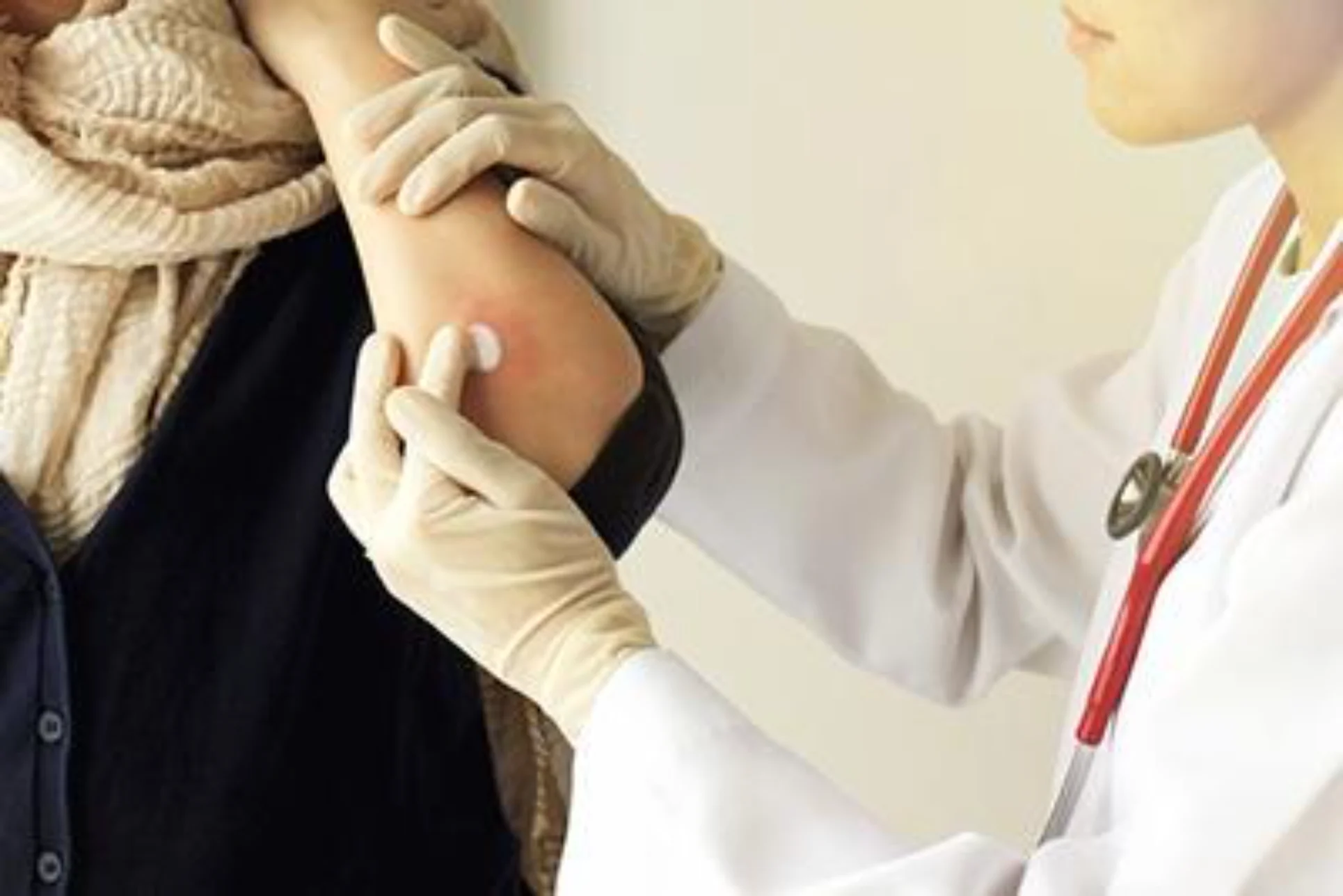 Dermatology minor procedure in Cortland NY